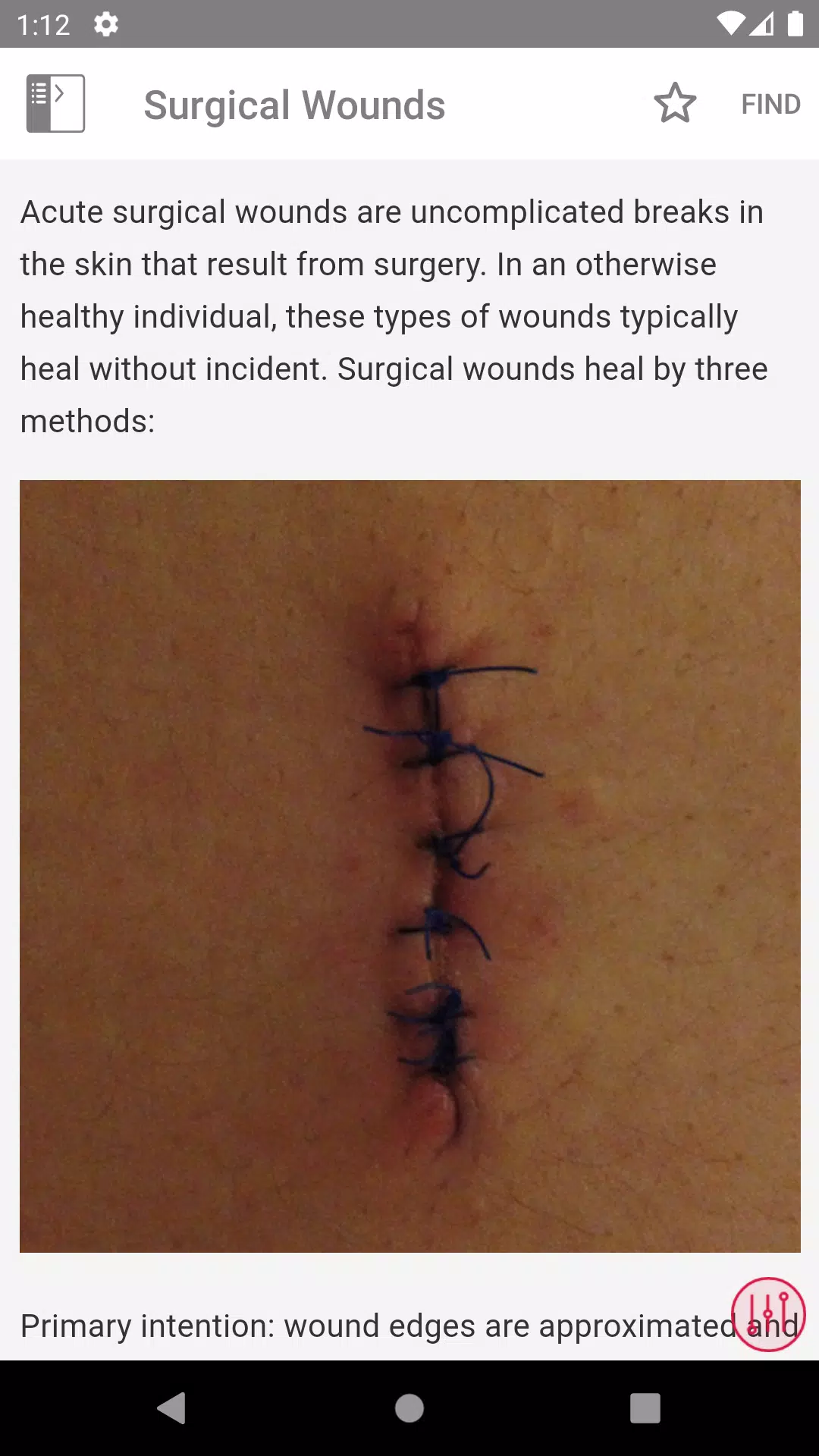 Wound Care MI Visual Screenshot 4